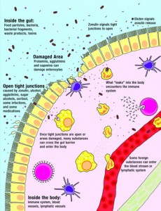 Leaky gut diagram