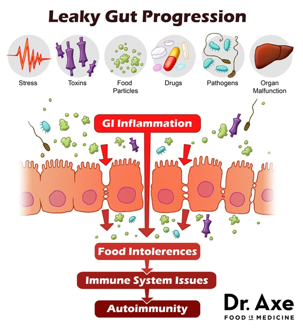 Leaky gut progression2