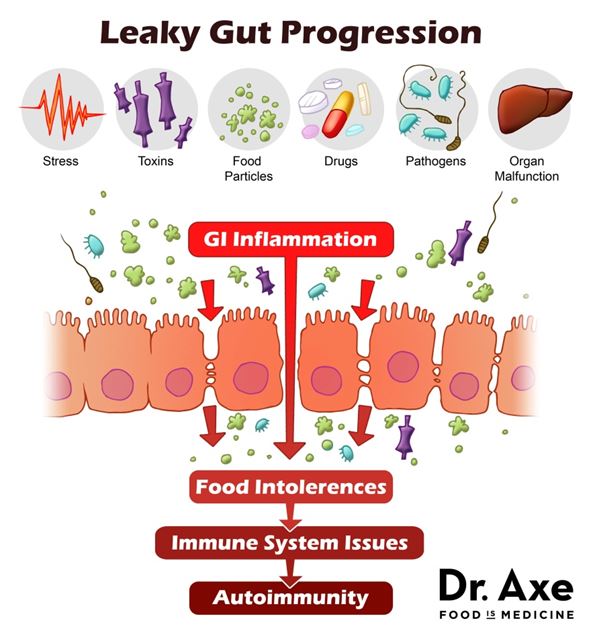 Leaky_gut_progression What's With Wheat